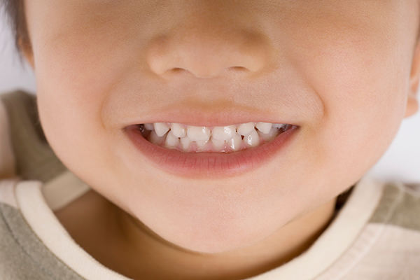 近年、永久歯が足りないお子様が増加しています