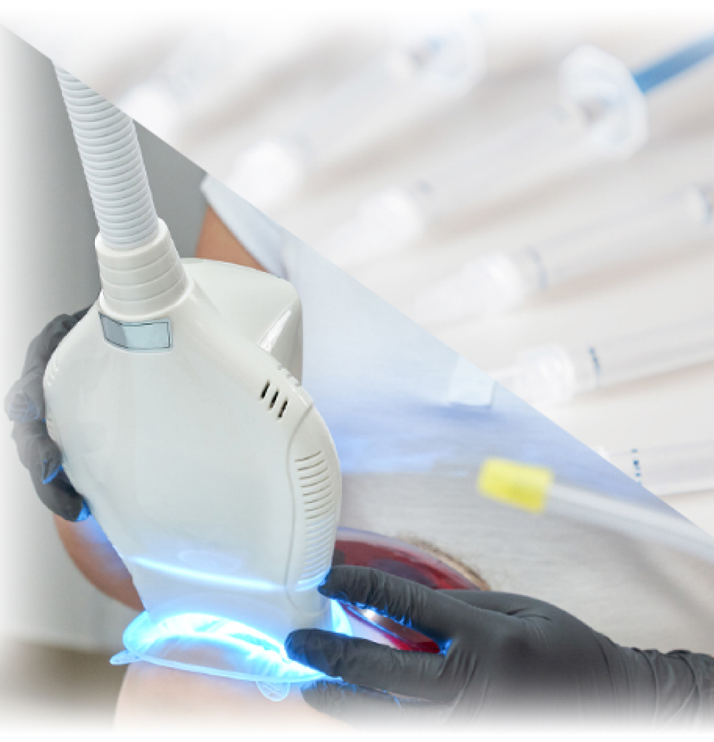 デュアルホワイトニング